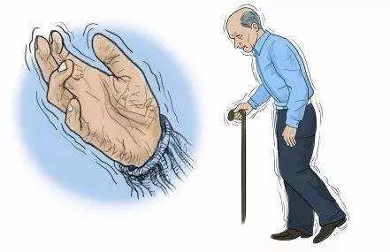 帕金森病的誤區，你知道嗎？