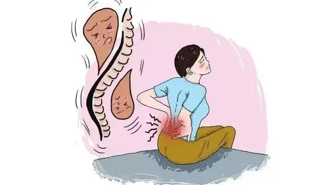 震驚！原來這些小習(xí)慣竟然可以預(yù)防腰突…