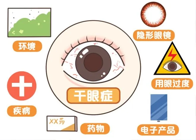 干眼癥是“絕癥”嗎？