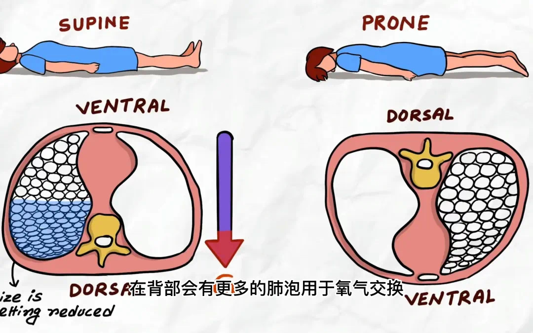 換個姿勢睡覺，竟然可以救命
